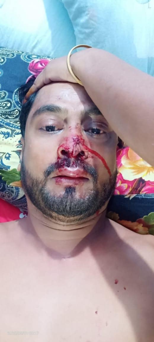 ফেনীতে গভীর রাতে সাংবাদিকের ওপর সন্ত্রাসী হামলা