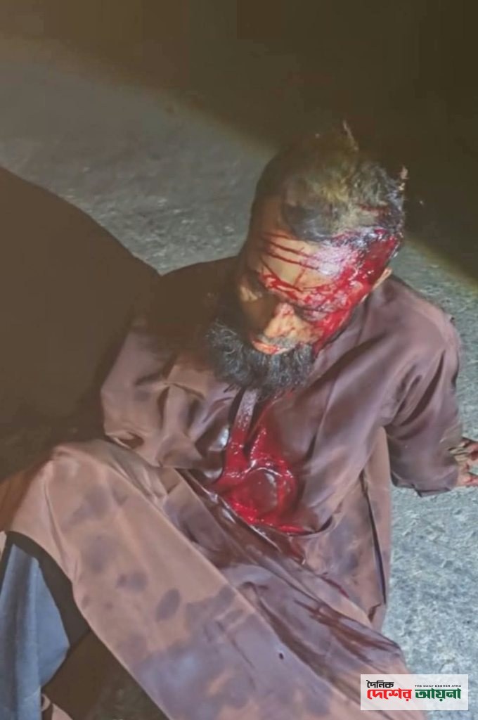 ছাগলনাইয়ায় চালককে কুপিয়ে হত্যা, অটোরিকশা ছিনতাই
