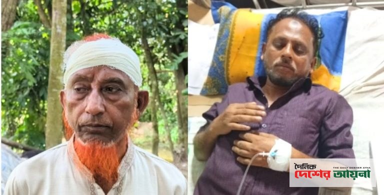 চৌদ্দগ্রামে মাদক সেবনে বাধা দেওয়ায় কিশোর গ্যাং এর হামলায় আহত ২